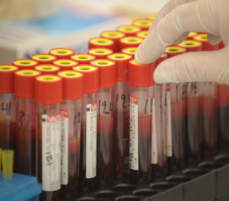 tubos con muestras de sangre como ejemplo